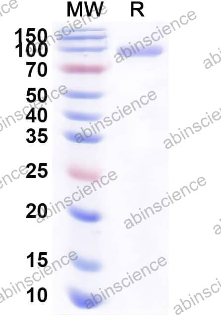 Mouse GAS6 Recombinant Protein (C-His)