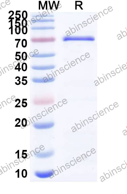 Mouse PTPN11 Recombinant Protein (N-His)