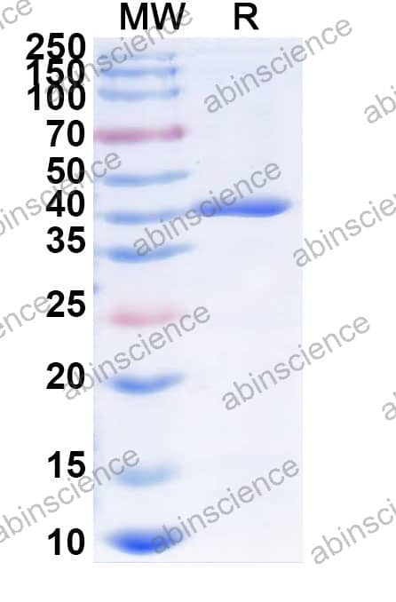 Mouse CKAP4 Recombinant Protein (N-GST & C-His)
