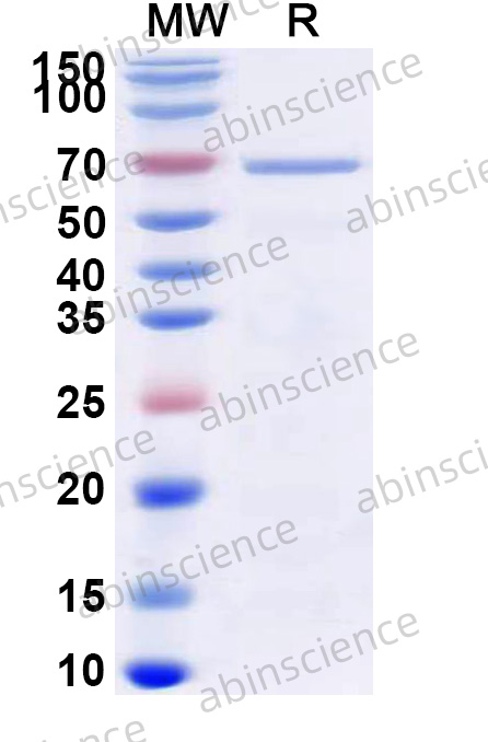 Mouse LGALS3BP Recombinant Protein (N-His)