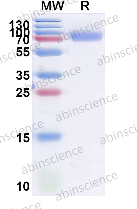 Human CR2-Crry Recombinant Protein (C-Strep)