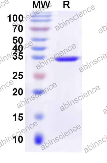 Mouse CD235a/GYPA Recombinant Protein (N-His-KSI)