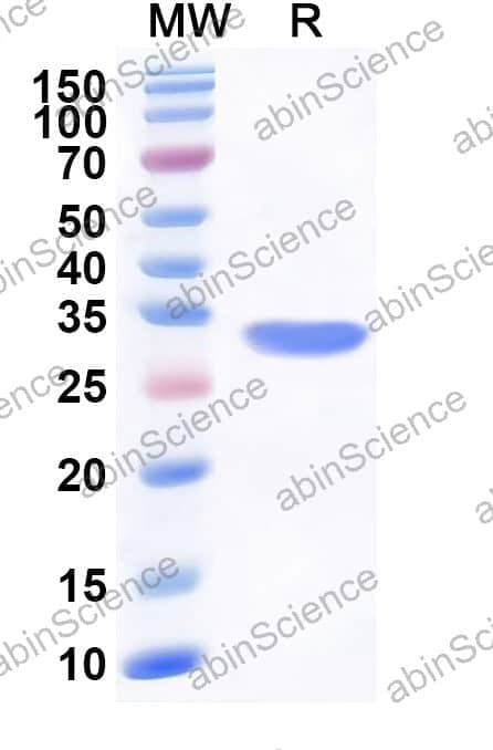 Mouse TULP3 Recombinant Protein (N-His)