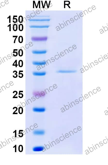 Mouse CD358/TNFRSF21 Recombinant Protein (C-His)