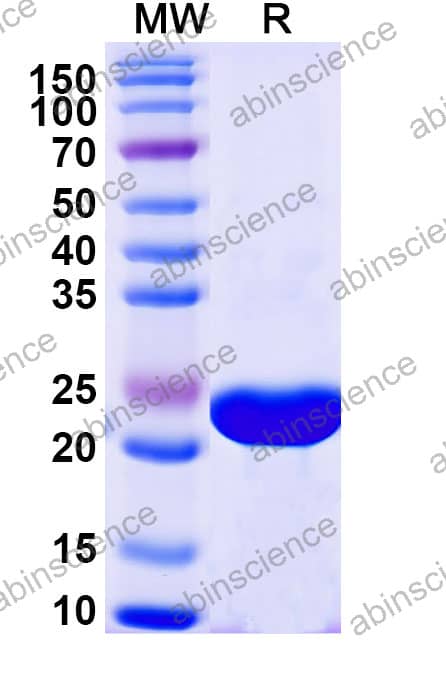 Mouse KLF7 Recombinant Protein (N-His)