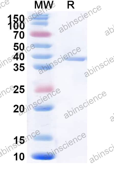 Mouse BRD4 Recombinant Protein (N-GST & C-His)