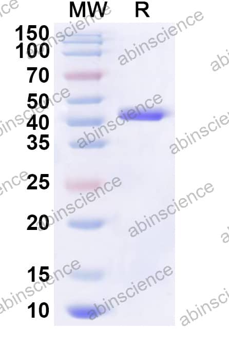 Mouse MBP Recombinant Protein (N-His-KSI)