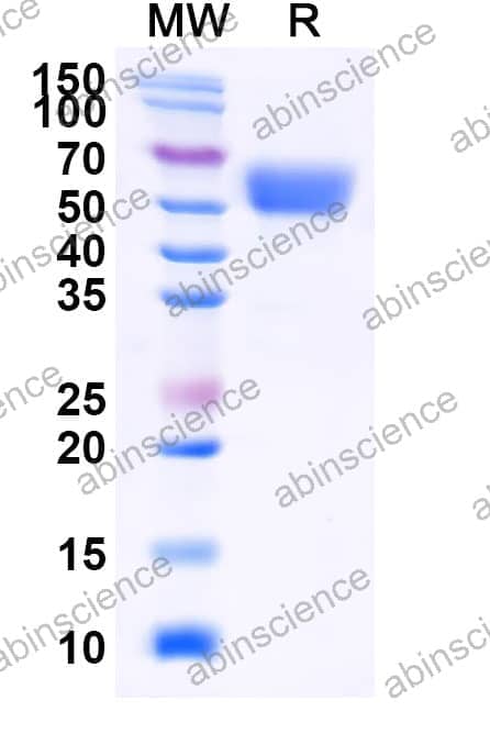 Mouse IFNB1 Recombinant Protein (C-Fc)