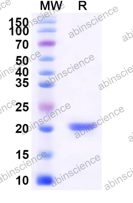 Mouse IFNB1 Recombinant Protein (N-His)