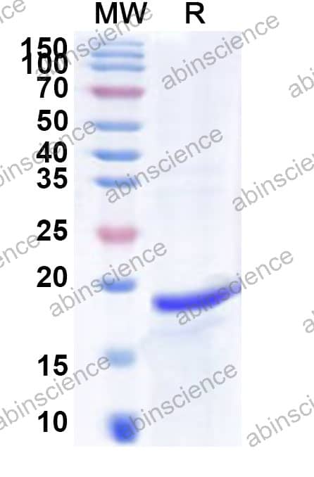 Mouse SOD1 Recombinant Protein (N-His)