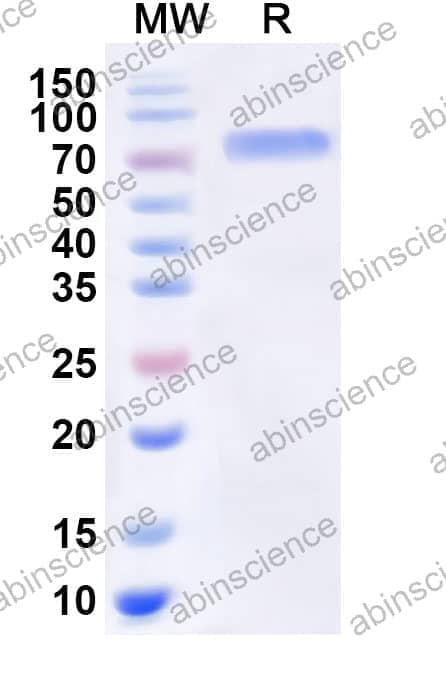 Mouse F9/Factor IX Recombinant Protein (C-Fc)