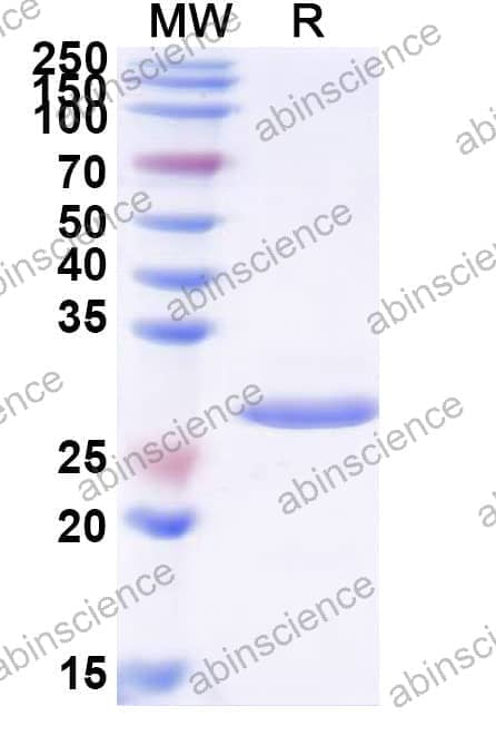 Mouse/Rat Netrin-1/NTN1 Recombinant Protein (N-His)