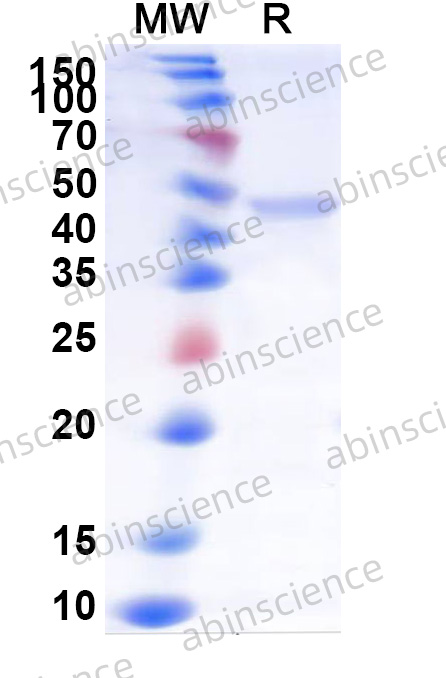 Mouse CRBN Recombinant Protein (N-His)