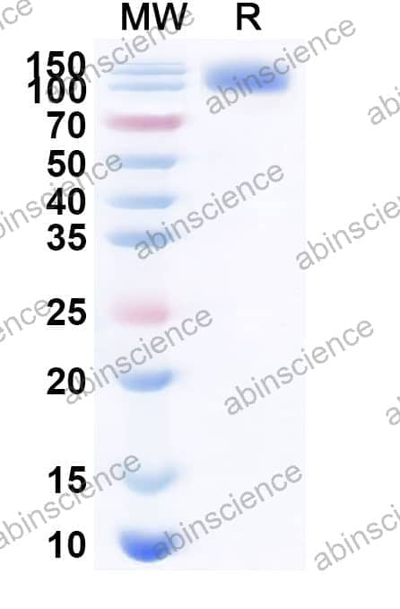 Mouse SEMA4C Recombinant Protein (C-Fc)