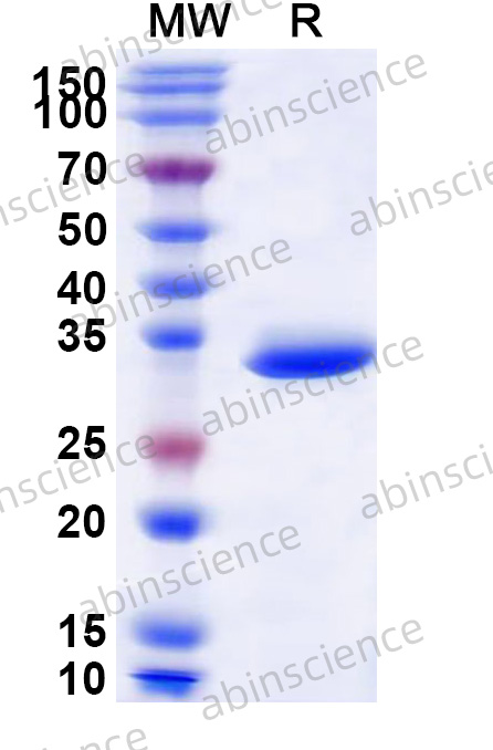Mouse CCL6 Recombinant Protein (N-GST&C-His)