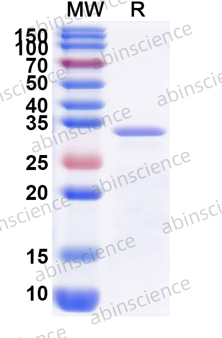 Mouse SENP3 Recombinant Protein (N-His)