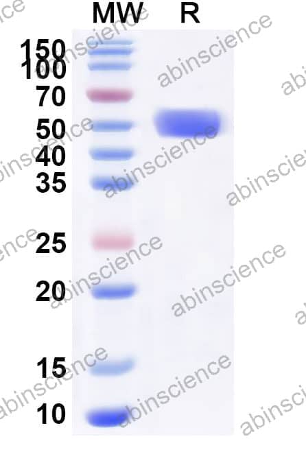 Mouse TIGIT Recombinant Protein (C-Fc)