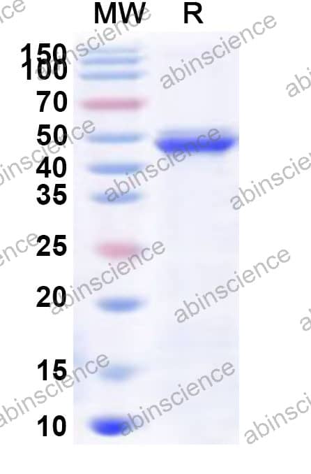 Mouse PTGIS Recombinant Protein (N-His)