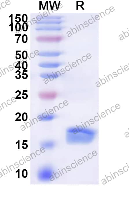 Mouse HSD17B12 Recombinant Protein (N-His)