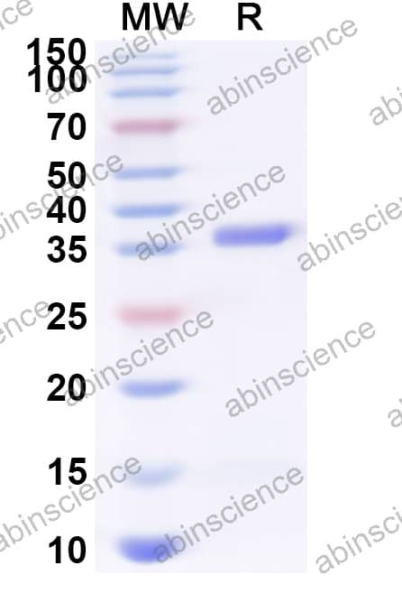 Mouse C3AR1 Recombinant Protein (N-His-KSI)