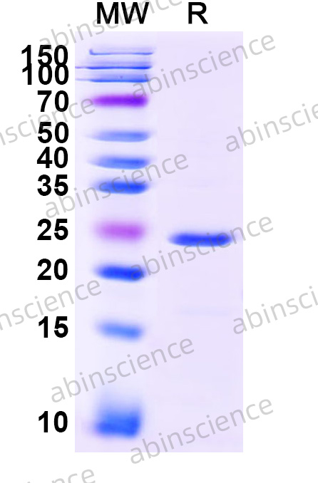 Mouse NRF1 Recombinant Protein (N-His)