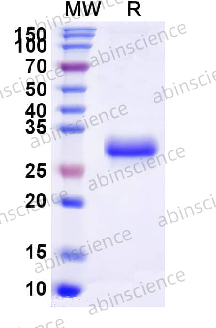 Mouse EFNB3 Recombinant Protein (C-His)