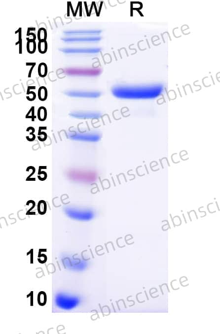 Mouse EFNB3 Recombinant Protein (C-Fc)