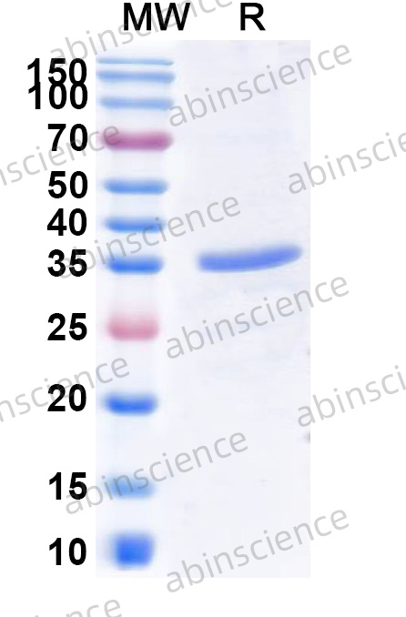 Mouse HCRT/Hypocretin Recombinant Protein (N-GST & C-His)