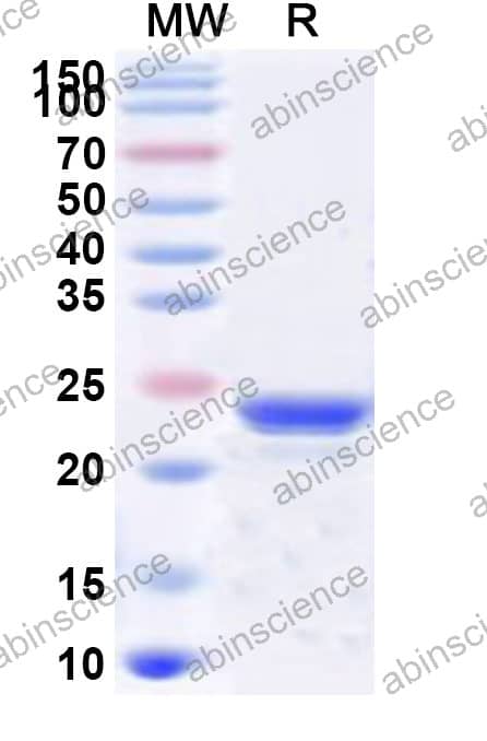 Mouse GSTA4 Recombinant Protein (N-His)