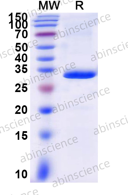 Mouse CXCL1/KC Recombinant Protein (N-GST & C-His)