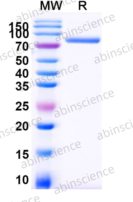 Mouse TNFRSF11B Recombinant Protein (C-Fc)