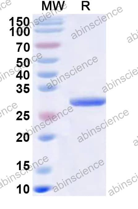 Mouse APOL8 Recombinant Protein (N-His-KSI)