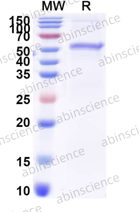 Mouse SORT1 Recombinant Protein (N-His)