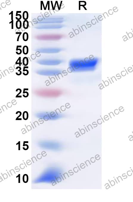 Mouse NRG4 Recombinant Protein (N-GST & C-His)
