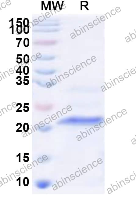 Mouse Apelin/APLN Recombinant Protein (N-His-KSI)