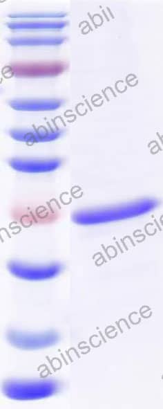 Mouse CLCF1 Recombinant Protein (N-His)