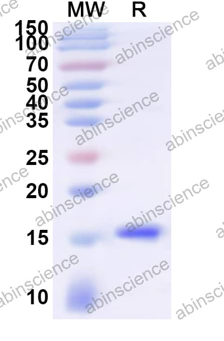 Mouse ITFG1 Recombinant Protein (N-His)