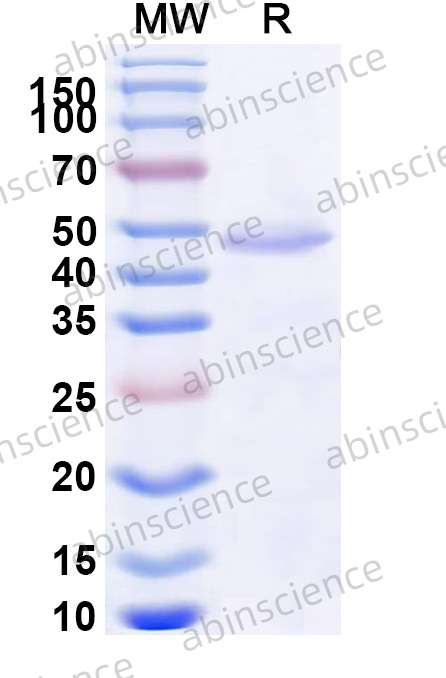 Mouse CD289/TLR9 Recombinant Protein (N-His)