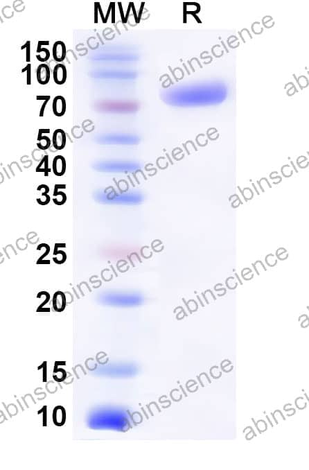 Mouse CD112/Nectin-2 Recombinant Protein (C-Fc)