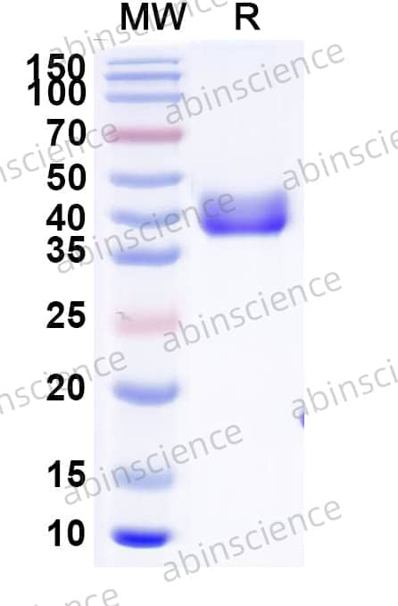 Mouse CD112/Nectin-2 Recombinant Protein (C-His)