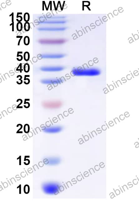 Mouse KISS1R Recombinant Protein (N-GST & C-His)