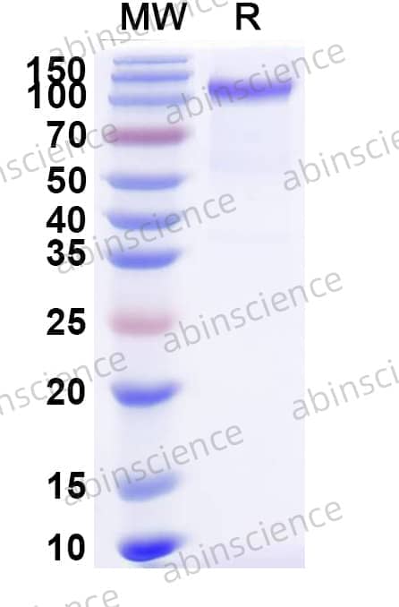 Mouse CD100/SEMA4D Recombinant Protein (C-His)