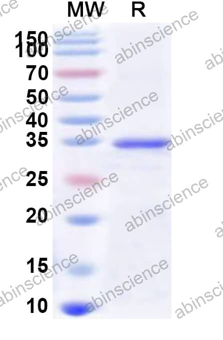 Mouse MLKL Recombinant Protein (N-His)
