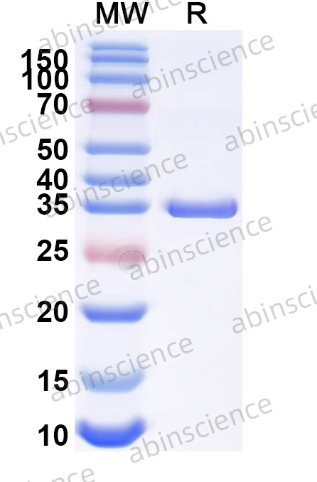 Mouse ZBP1 Recombinant Protein (N-His)