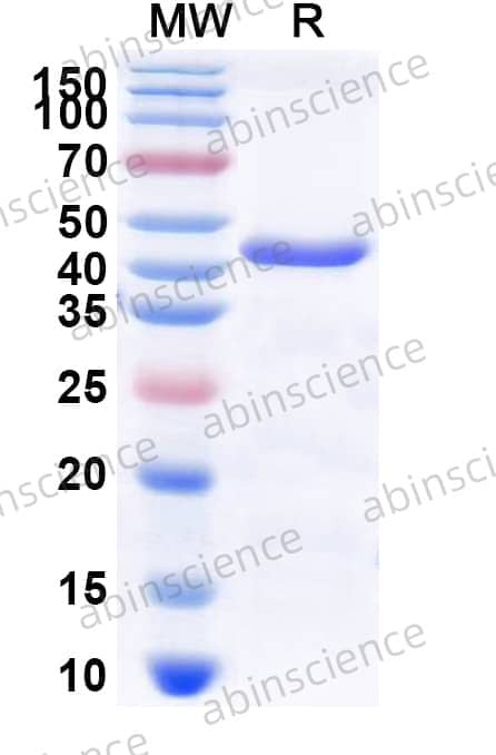 Mouse SNX9 Recombinant Protein (N-His)