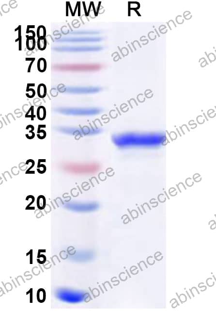 Mouse P2RX7 Recombinant Protein (N-His)