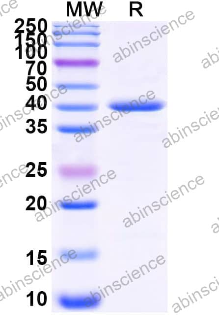 Mouse GHRL Recombinant Protein (N-GST & C-His)