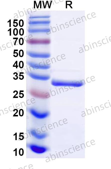 Mouse NR1H4/FXR Recombinant Protein (N-His)