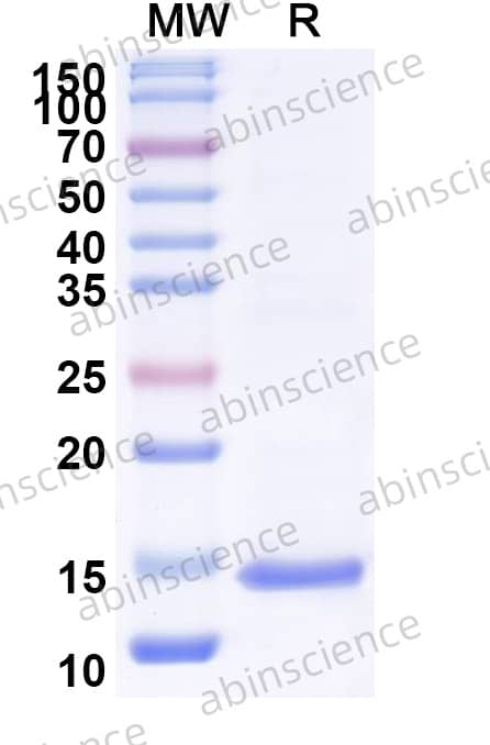 Mouse IL22 Recombinant Protein (N-His)