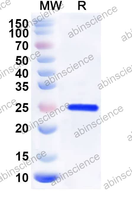 Mouse EFNA5 Recombinant Protein (C-His)